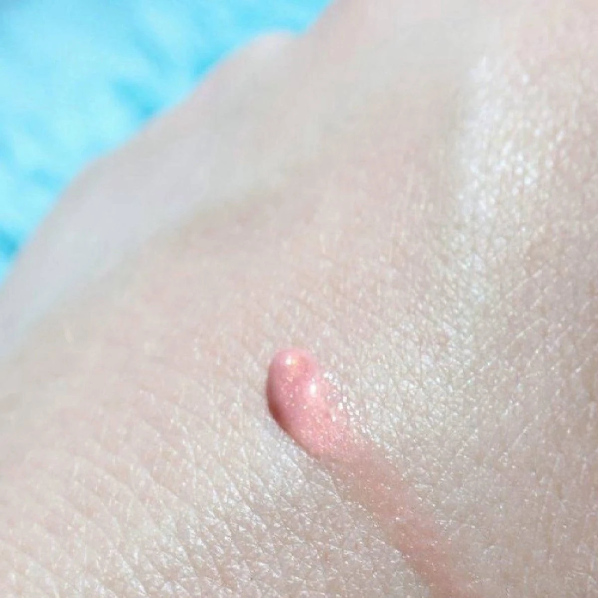 Lippenbalsem Natural Pink Biodermal Sun Lipbalm Lipbalsem SPF25 - Tube 12 Ml - 5 Lippenbalsem Natural Pink Biodermal Sun Lipbalm Lipbalsem SPF25 - Tube 12 Ml - - Afbeelding 5