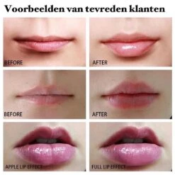 BenjaBeauty Lip Plumper - Lippen - Lipstick - Lippenbalsem - Rood - Wit -Lip Make Up Winkel 1200x1200 870