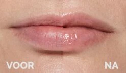 Instant Effects - 3D Lip Plumper Lipgloss Lip Filler - 20% Vollere Lippen In Slechts 2 Minuten! -Lip Make Up Winkel 1200x696